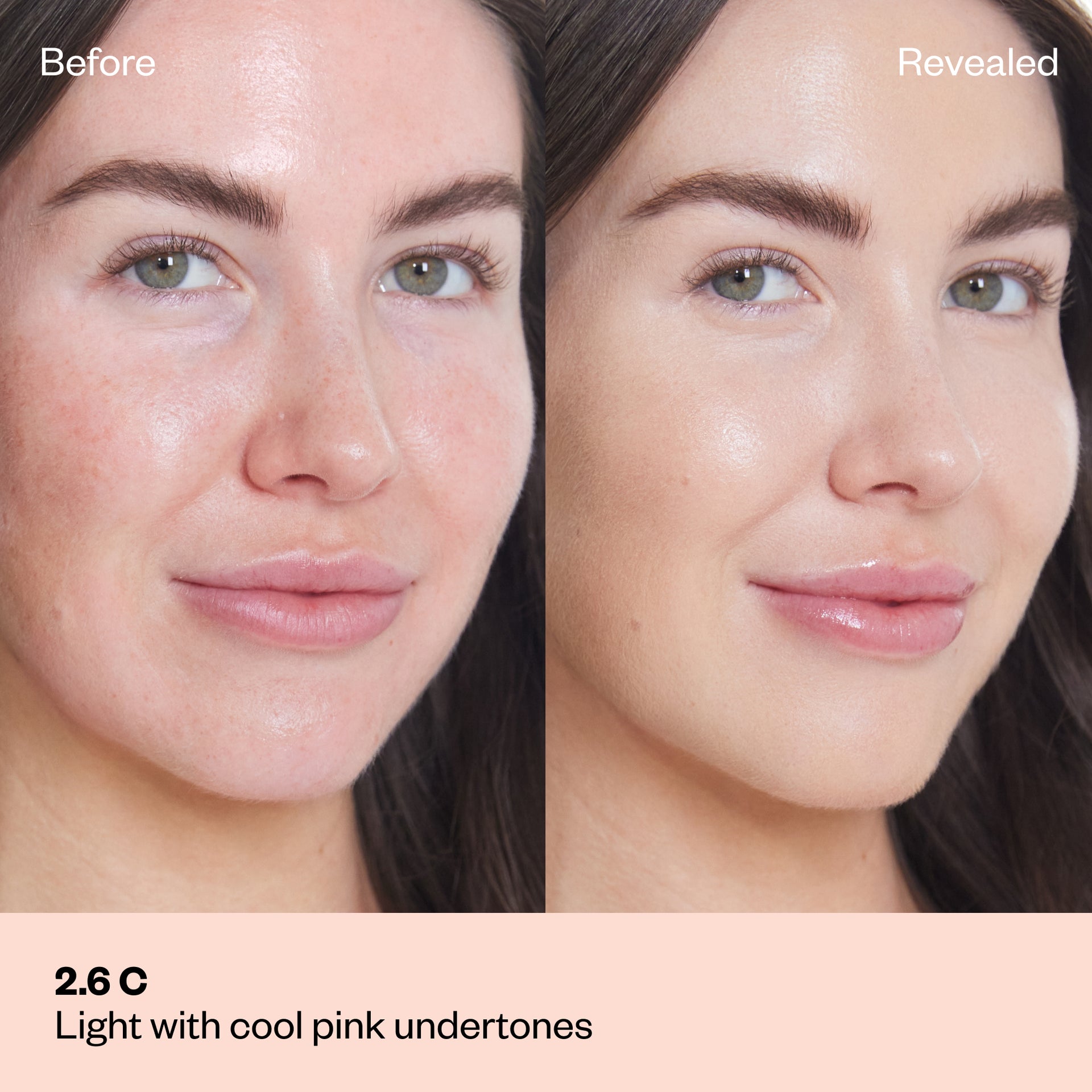 Shade 2.0 C: A "Before and After" comparison of a model with a light complexion and some surface redness.The shade is Light with cool pink undertones.