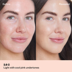 Shade 2.0 C: A "Before and After" comparison of a model with a light complexion and some surface redness.The shade is Light with cool pink undertones.