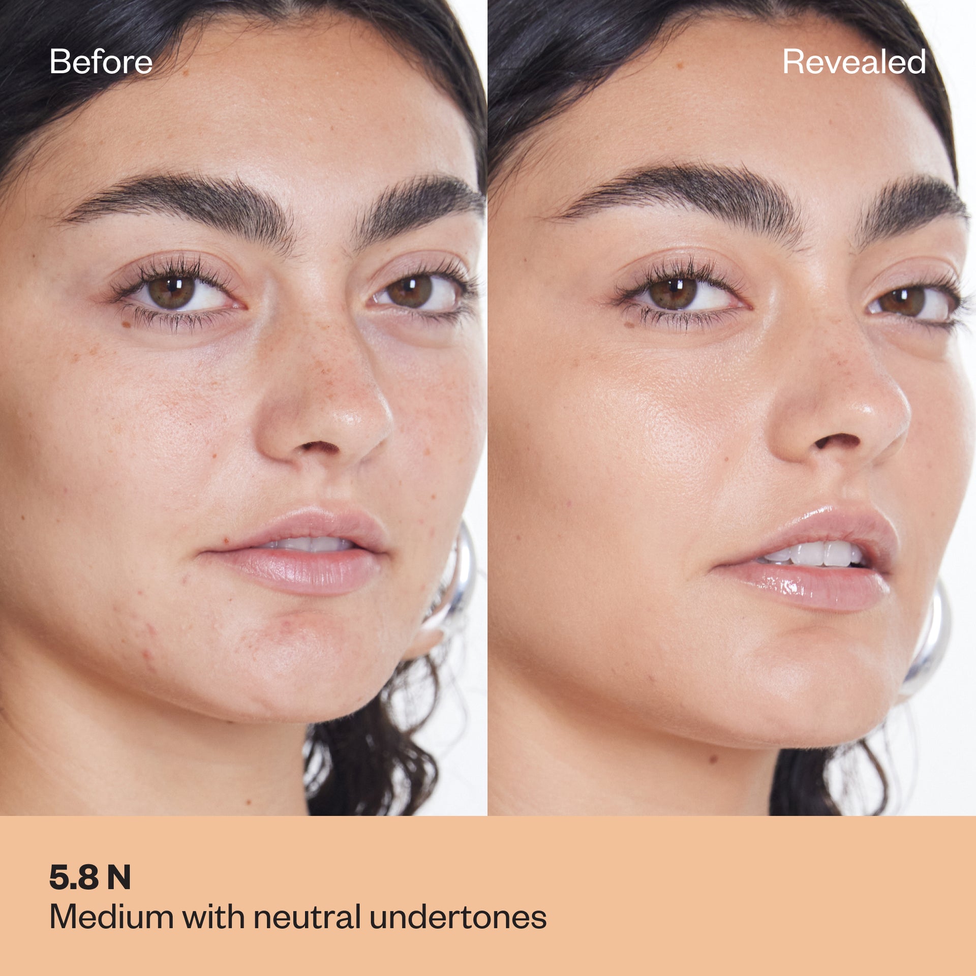 Before and after results for concealer shade 5.5 N on medium skin with neutral undertones.
